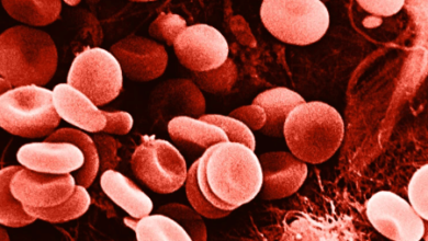 Red:1rjoyd32uuy= Blood