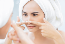 How to Treat and Prevent Blackheads Effectively