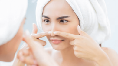 How to Treat and Prevent Blackheads Effectively